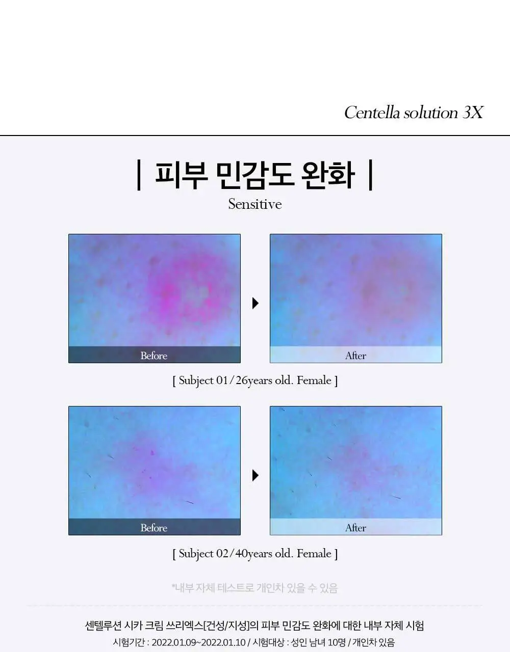 피부미 센텔루션 시카 크림 3X 100ml [지복합성] 상세페이지 7